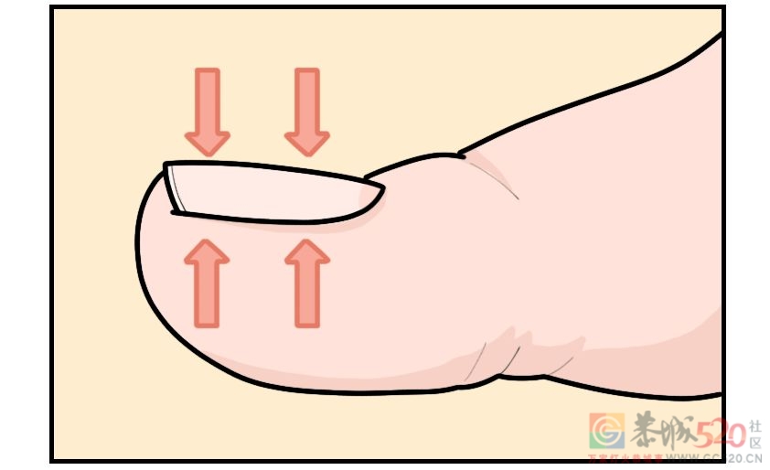 剪指甲的一个错误习惯，让很多人痛苦不堪571 / 作者:健康小天使 / 帖子ID:295200
