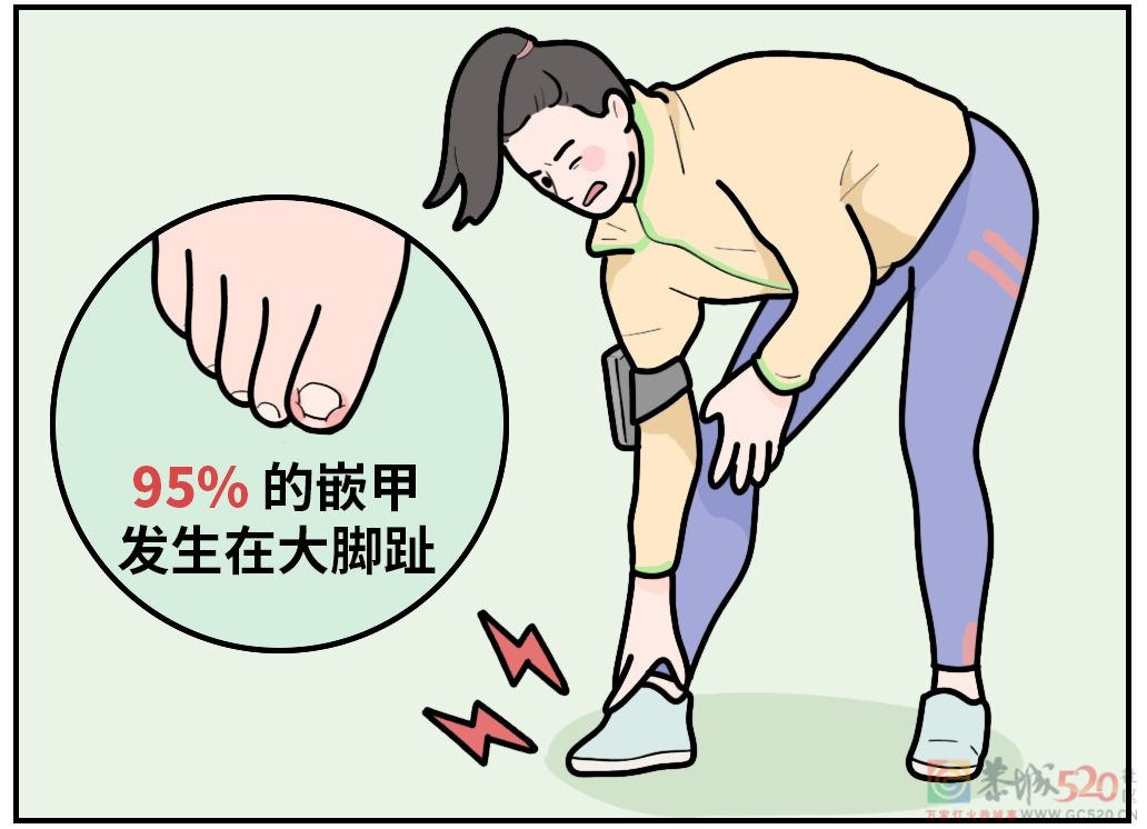 剪指甲的一个错误习惯，让很多人痛苦不堪726 / 作者:健康小天使 / 帖子ID:295200