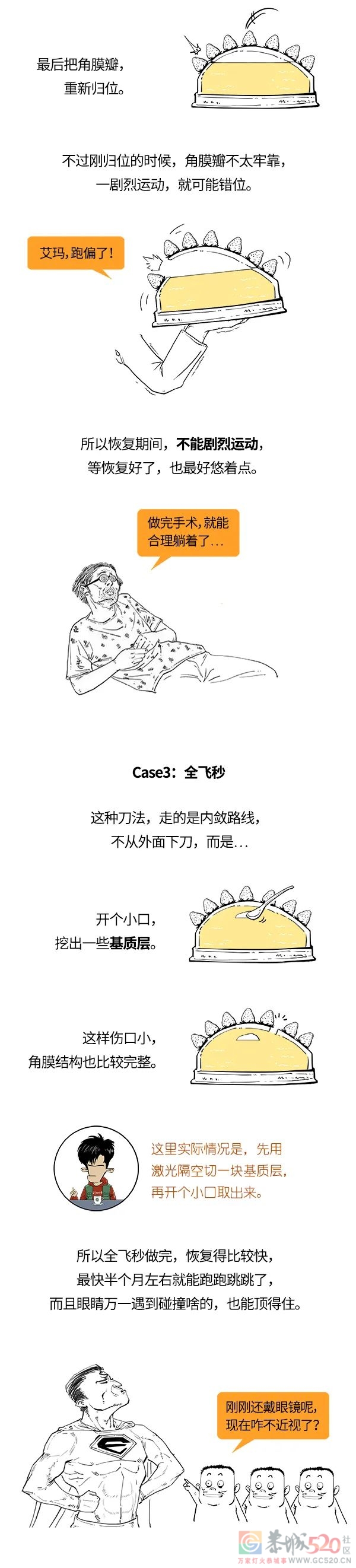 激光近视手术，不是谁都能做？319 / 作者:儿时的回忆 / 帖子ID:296399