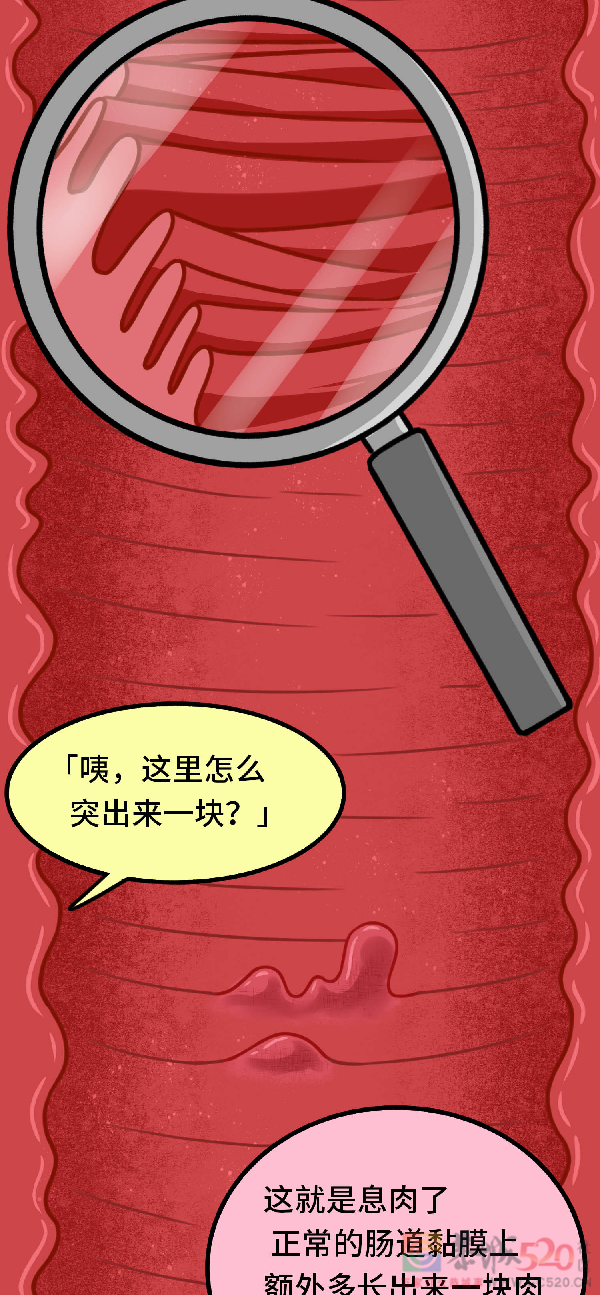 发现就是中晚期的肠癌，一个方法可以避免913 / 作者:健康小天使 / 帖子ID:296541