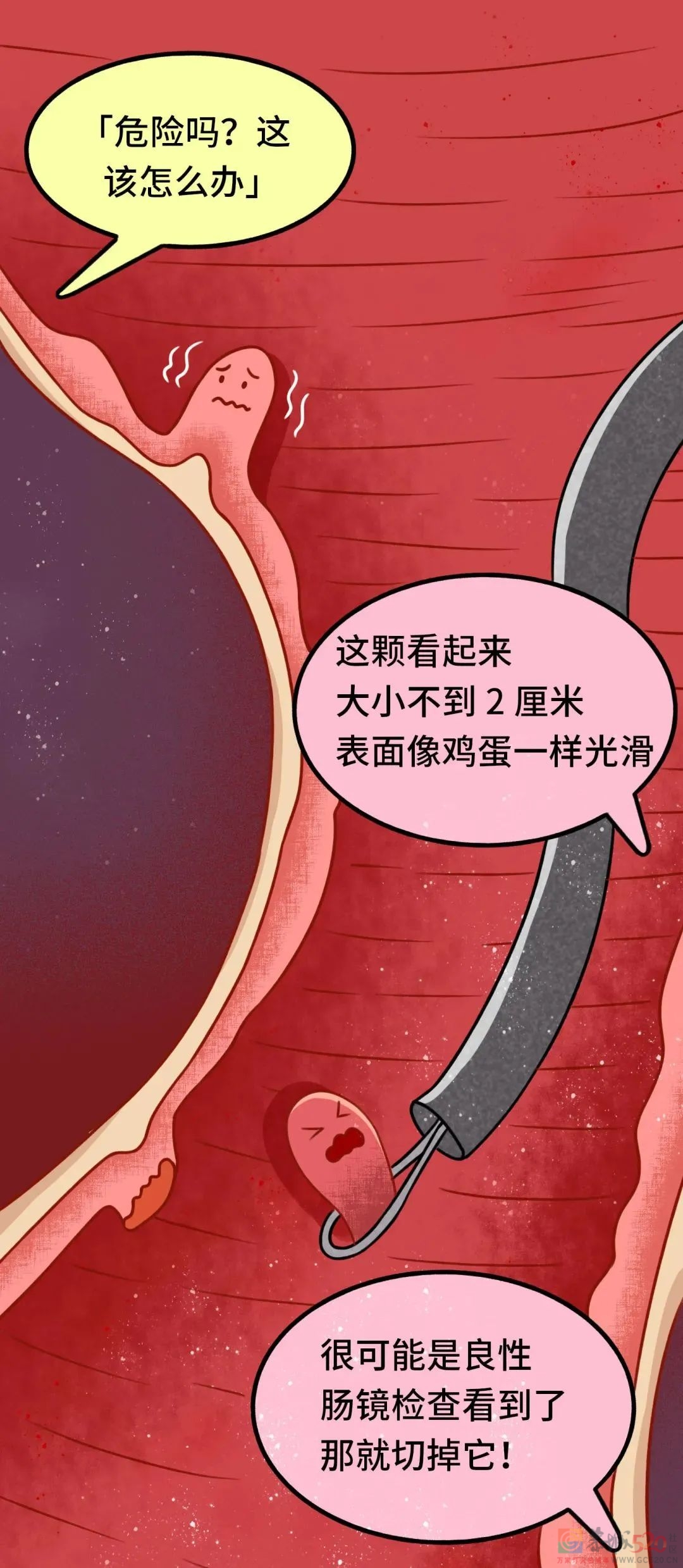 发现就是中晚期的肠癌，一个方法可以避免540 / 作者:健康小天使 / 帖子ID:296541