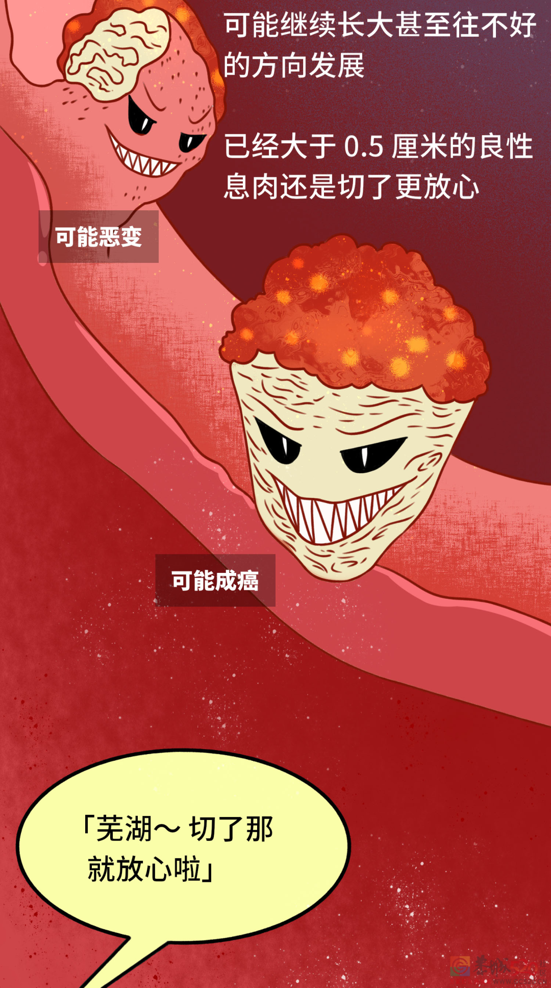 发现就是中晚期的肠癌，一个方法可以避免898 / 作者:健康小天使 / 帖子ID:296541