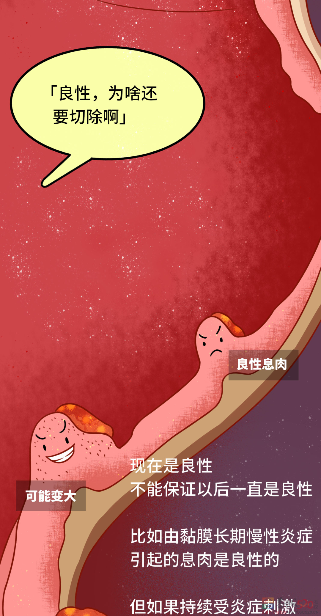 发现就是中晚期的肠癌，一个方法可以避免458 / 作者:健康小天使 / 帖子ID:296541