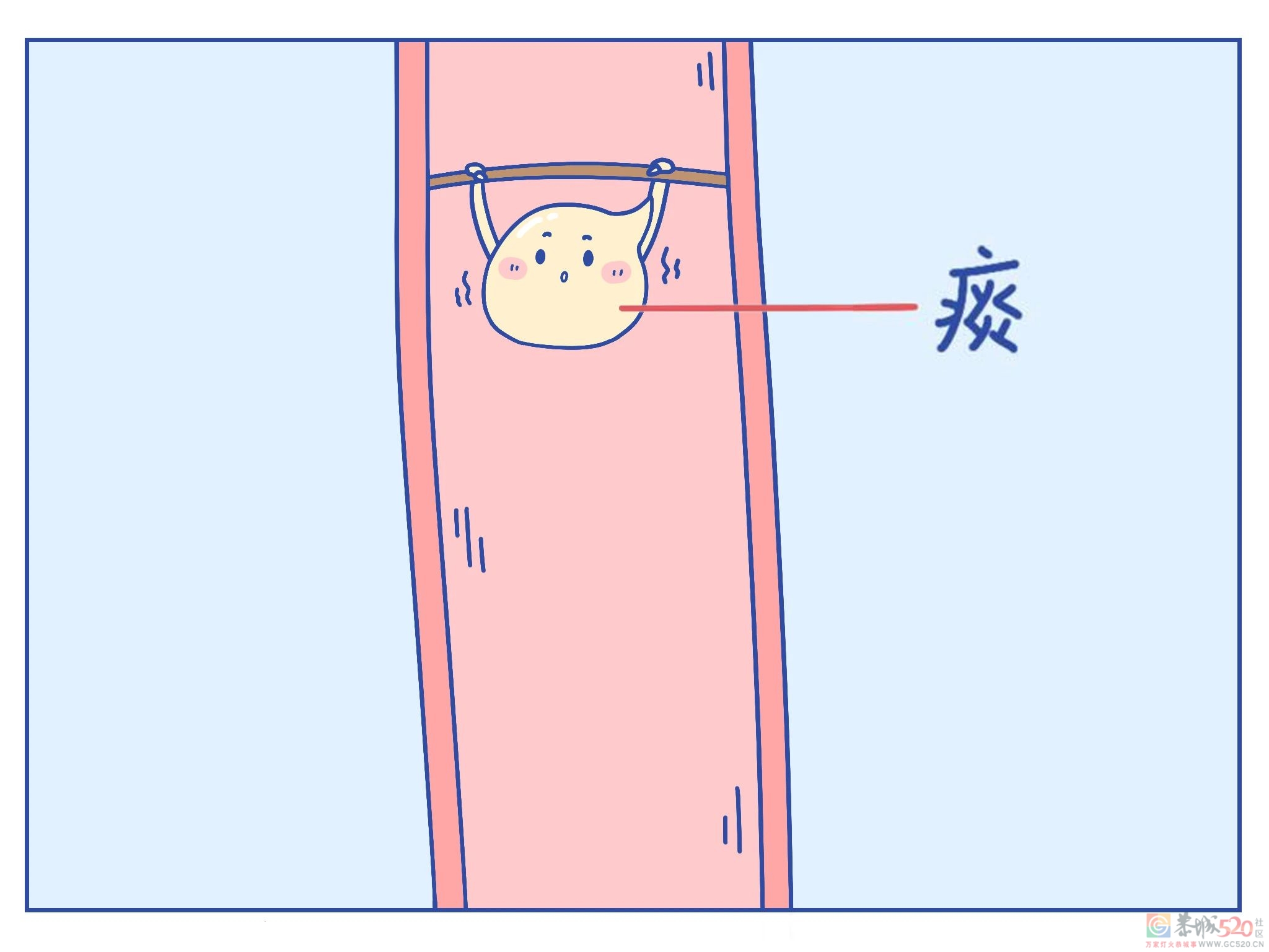 把痰咽回去，会不会对身体不好啊？0 / 作者:健康小天使 / 帖子ID:297180