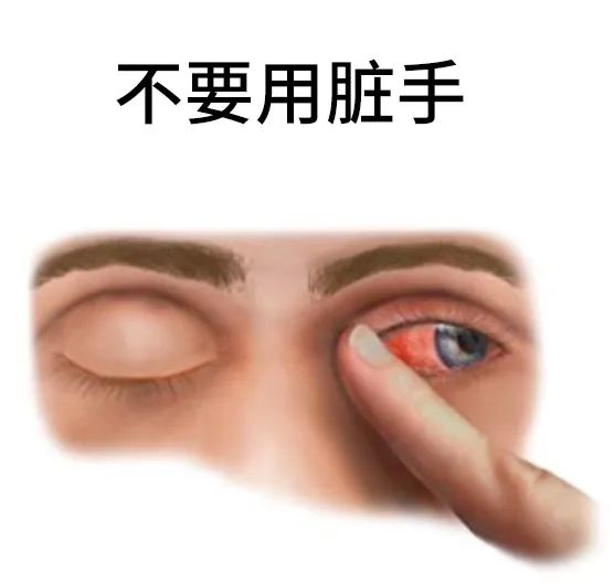 一个让眼球变形的小动作，你可能每天都在做214 / 作者:健康小天使 / 帖子ID:298013