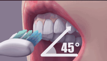 有一种口腔病叫“牙龈线后移”，只要疼了立即就医218 / 作者:健康小天使 / 帖子ID:300922