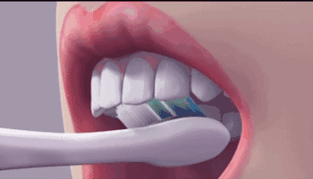 有一种口腔病叫“牙龈线后移”，只要疼了立即就医796 / 作者:健康小天使 / 帖子ID:300922