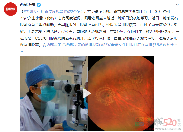 眼前总有黑影飘的人：你的视网膜可能“裂”了526 / 作者:健康小天使 / 帖子ID:301202