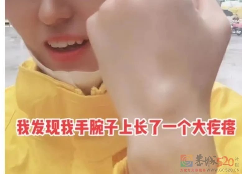 能逃过腱鞘炎的年轻人，已经不多了289 / 作者:儿时的回忆 / 帖子ID:302000