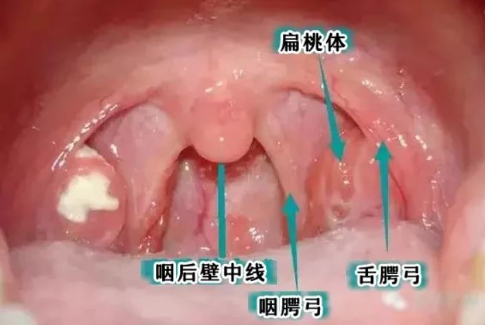 “宝鹃嗓”、“吞刀片”的康复攻略来了！学4招对症缓解255 / 作者:健康小天使 / 帖子ID:302672
