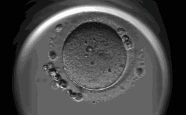 唯一病因明确的癌症，正在找上年轻女性……549 / 作者:健康小天使 / 帖子ID:303971