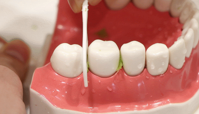 牙齿上长的这种「斑」，刷牙只能清除三分之二18 / 作者:健康小天使 / 帖子ID:306126