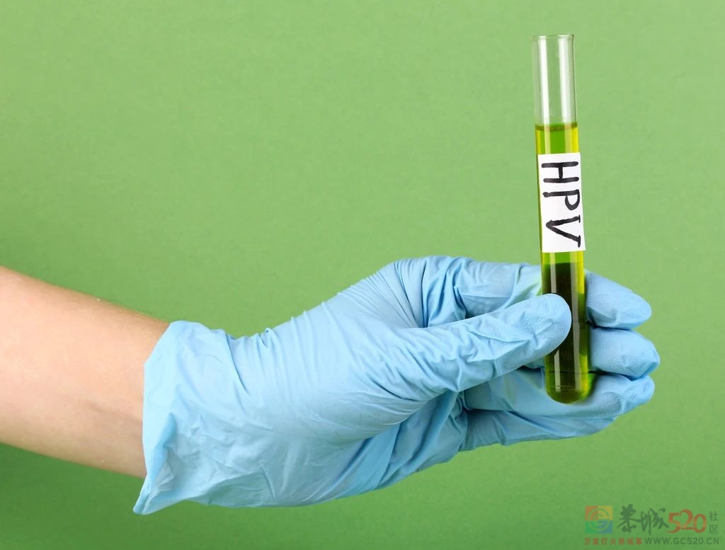 女性一生感染HPV几率高达80%！多数人两年内可“自愈”92 / 作者:健康小天使 / 帖子ID:306645