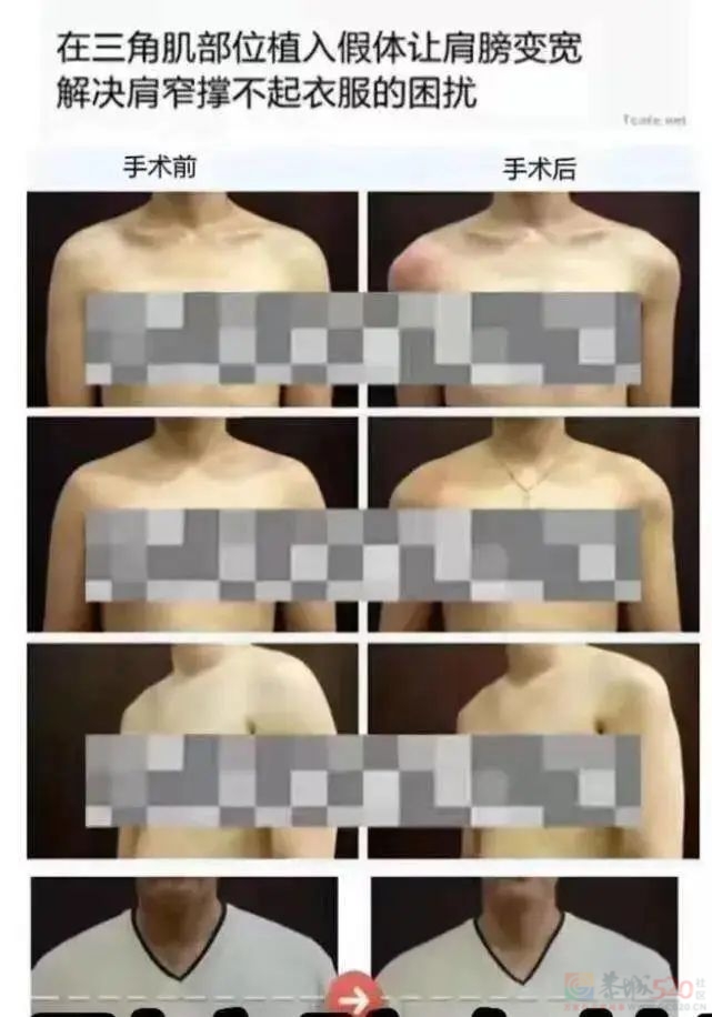 “细狗”才是让男人破防的终极武器893 / 作者:儿时的回忆 / 帖子ID:307208