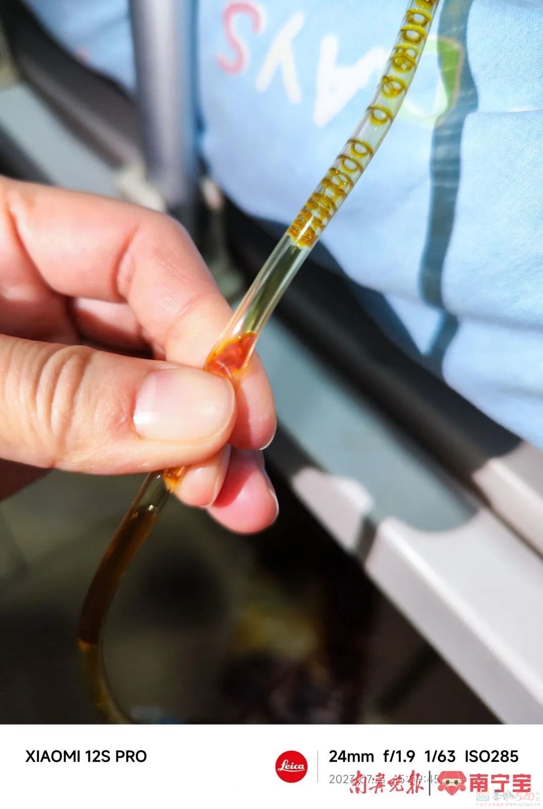 头皮发麻！广西一女子体内惊现大量“瓜子”活虫，只因这个习惯……663 / 作者:健康小天使 / 帖子ID:308769