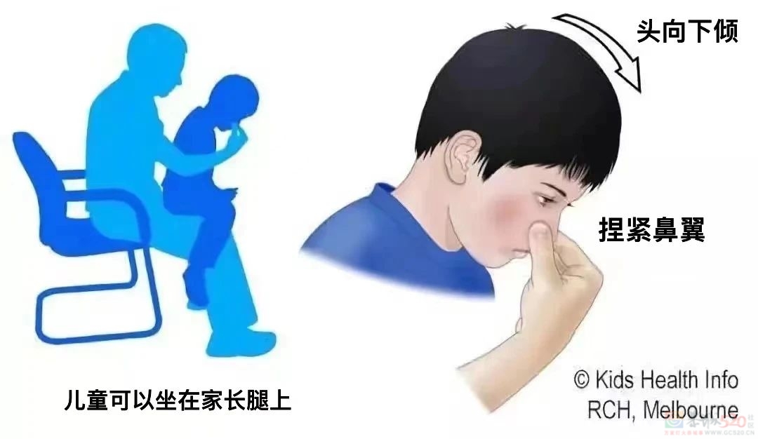 流鼻血不一定是“干燥上火”，还隐藏着这些疾病997 / 作者:健康小天使 / 帖子ID:309787