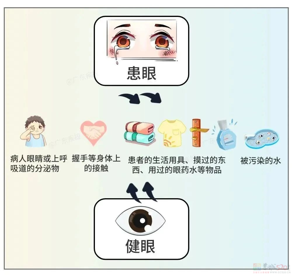 近期高发！这种传染性极强的“眼病”易全家中招958 / 作者:健康小天使 / 帖子ID:310474