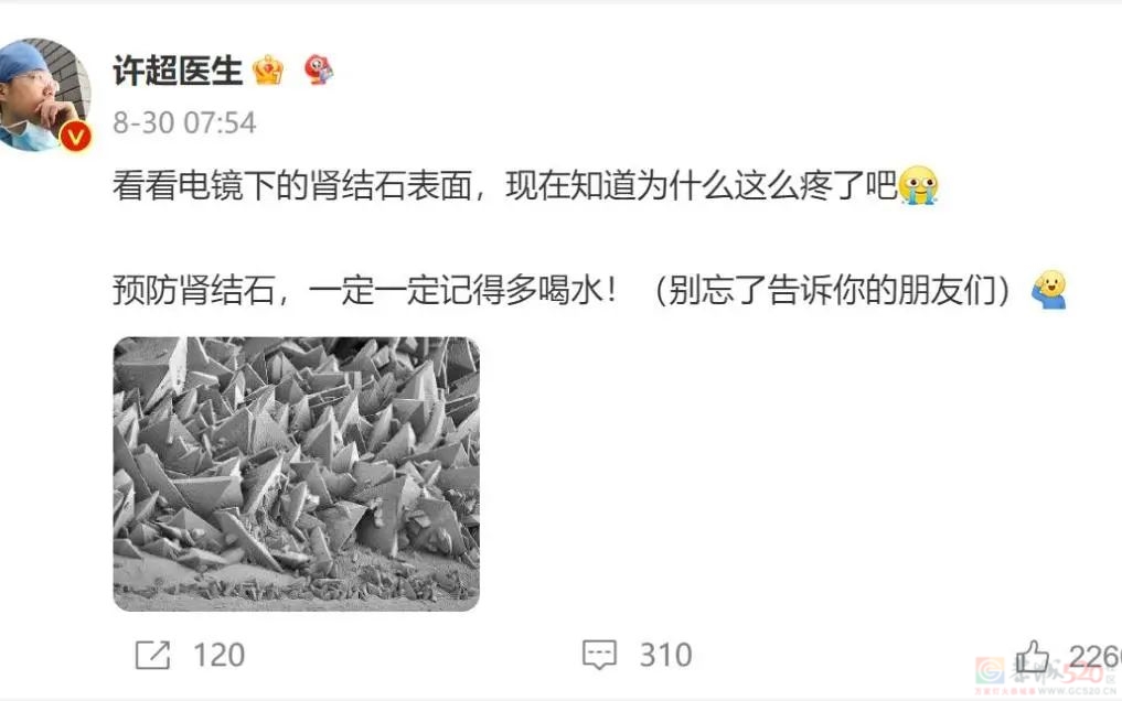 看过显微镜下的「肾结石」，再也不敢少喝水了946 / 作者:健康小天使 / 帖子ID:310529