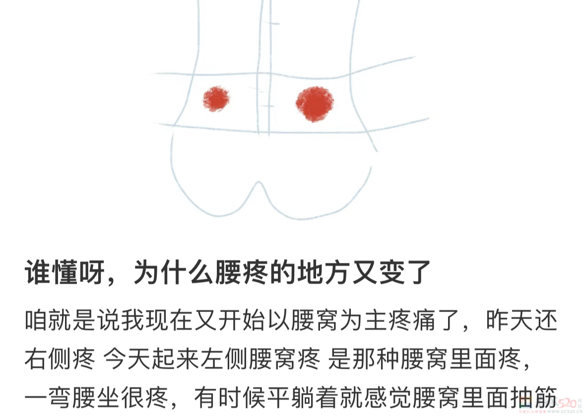 总「腰窝」疼的人，骨科医生示范2个缓解动作77 / 作者:健康小天使 / 帖子ID:311207