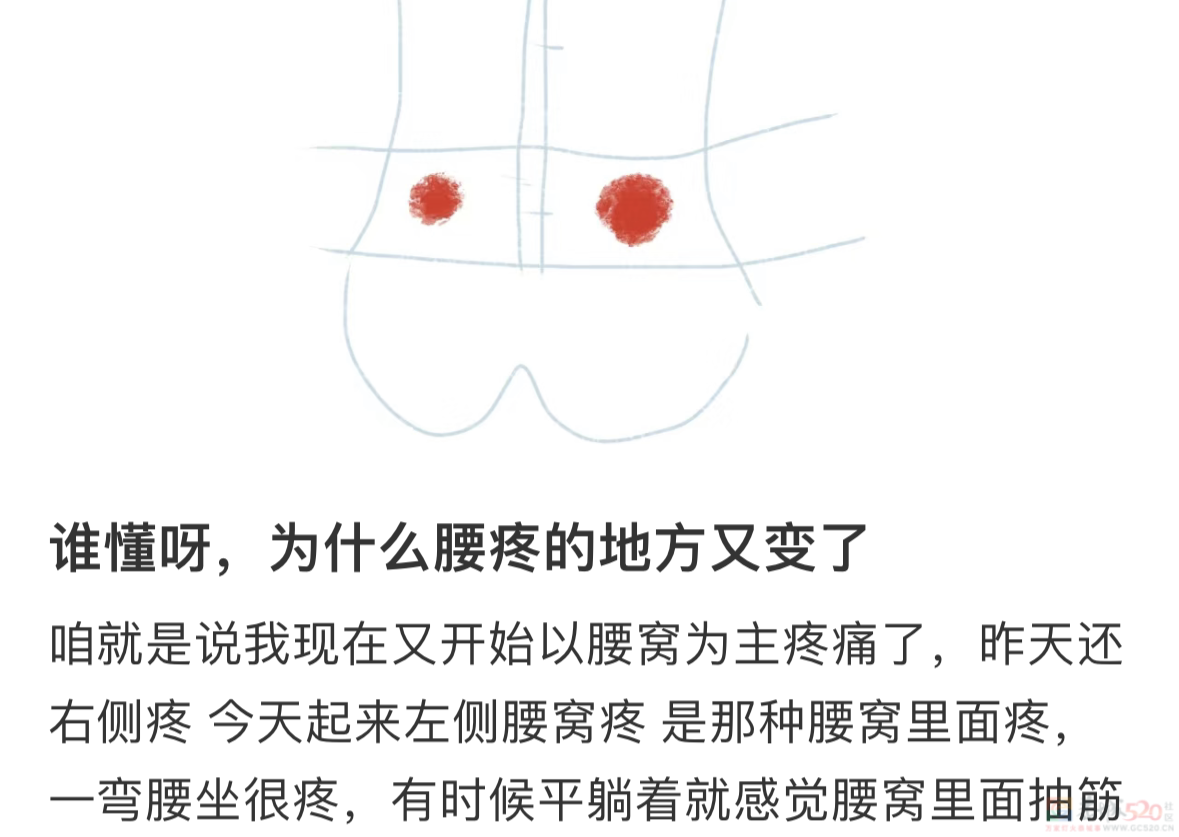 总「腰窝」疼的人，骨科医生示范2个缓解动作365 / 作者:健康小天使 / 帖子ID:311207