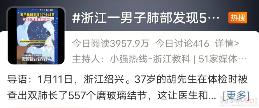 最爱长结节的工作上热搜了，年轻人看见就气得翻白眼425 / 作者:儿时的回忆 / 帖子ID:313085