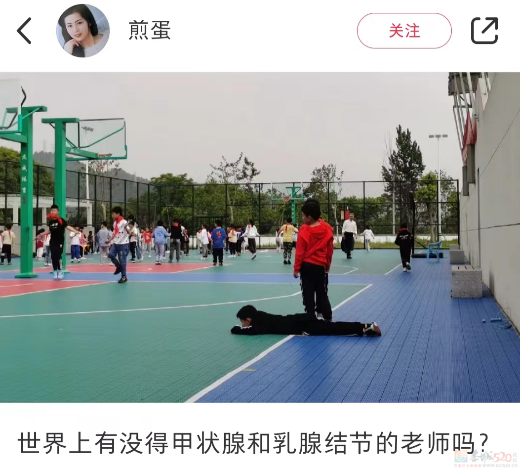 最爱长结节的工作上热搜了，年轻人看见就气得翻白眼865 / 作者:儿时的回忆 / 帖子ID:313085