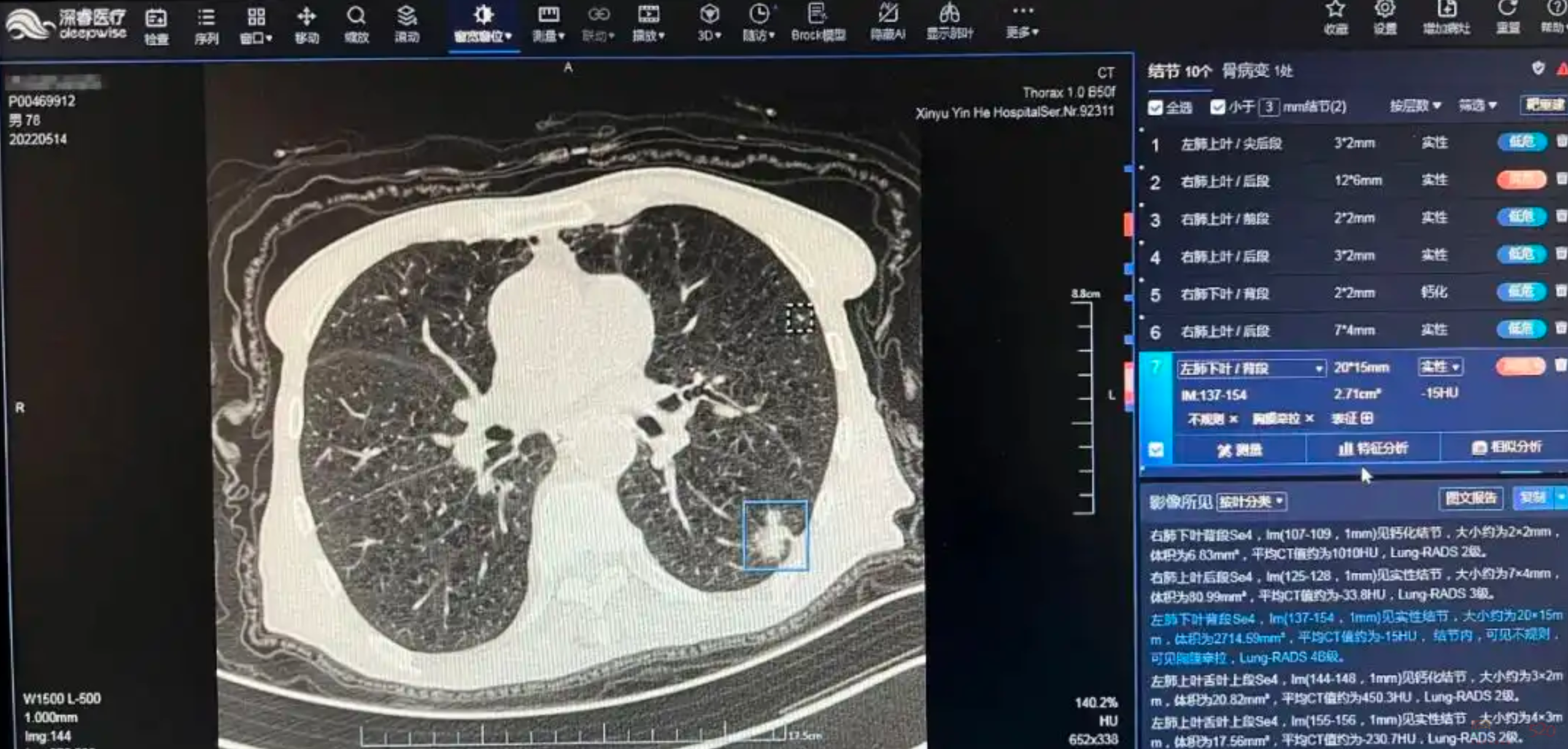 最爱长结节的工作上热搜了，年轻人看见就气得翻白眼37 / 作者:儿时的回忆 / 帖子ID:313085