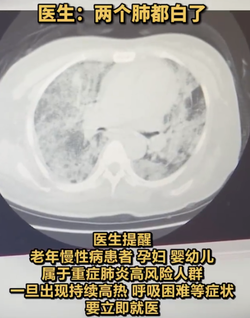 女子得流感硬扛10天险丧命！紧急提醒799 / 作者:健康小天使 / 帖子ID:313092
