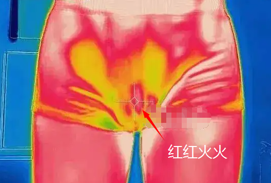 男生秋裤前为啥开个洞？居然TM不是用来尿尿的！631 / 作者:儿时的回忆 / 帖子ID:313273