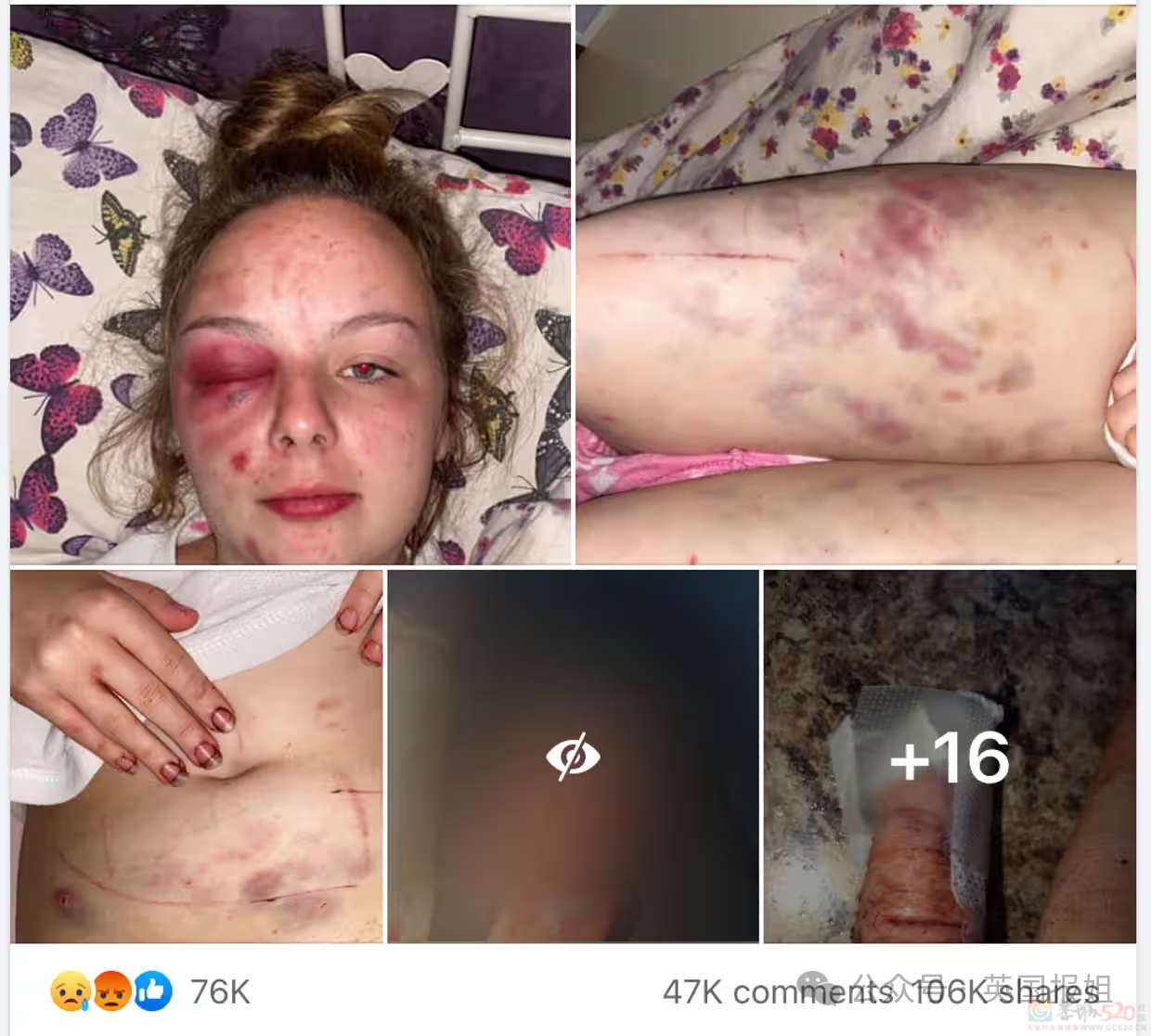 19岁女孩遭多次暴力侵犯，反被判刑8年半？真相反转震撼英国：她故意用铁锤砸自己编故事！979 / 作者:放眼看世界 / 帖子ID:313312