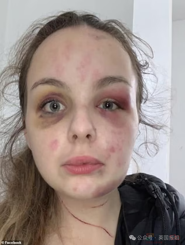 19岁女孩遭多次暴力侵犯，反被判刑8年半？真相反转震撼英国：她故意用铁锤砸自己编故事！606 / 作者:放眼看世界 / 帖子ID:313312
