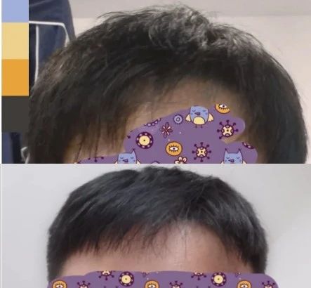 爆火的“辛芷蕾头”，把大学生害惨了！791 / 作者:儿时的回忆 / 帖子ID:313542