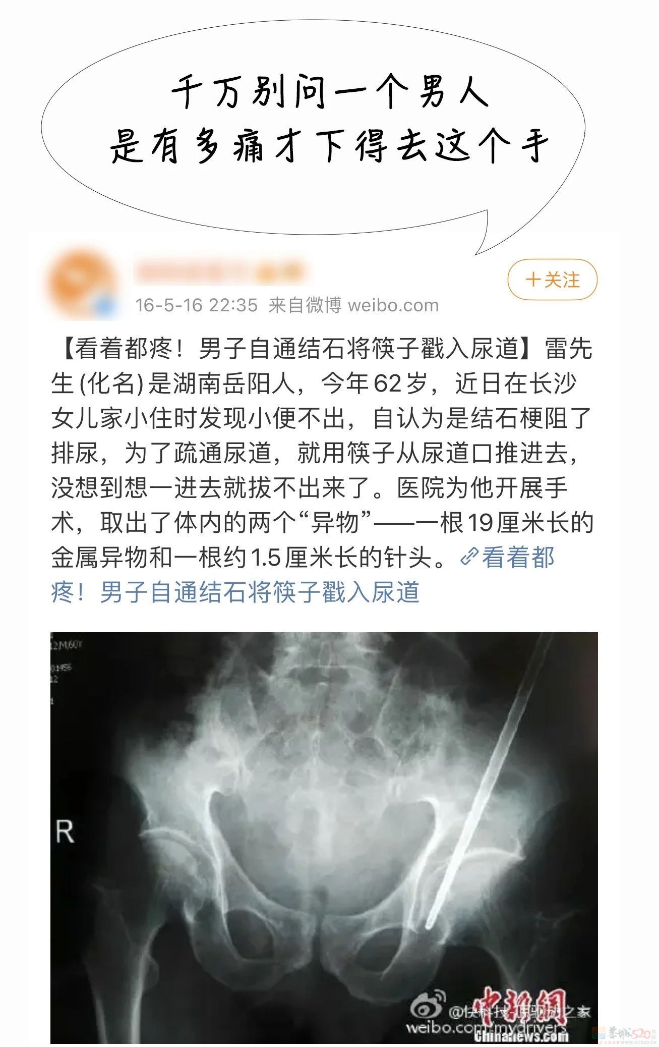 过年这样吃，小心腰痛生“石”，严重没命！6种人特别要小心829 / 作者:健康小天使 / 帖子ID:313599