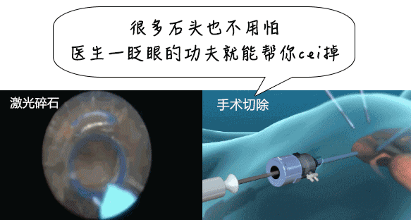 过年这样吃，小心腰痛生“石”，严重没命！6种人特别要小心590 / 作者:健康小天使 / 帖子ID:313599