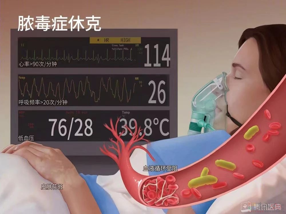 过年这样吃，小心腰痛生“石”，严重没命！6种人特别要小心365 / 作者:健康小天使 / 帖子ID:313599