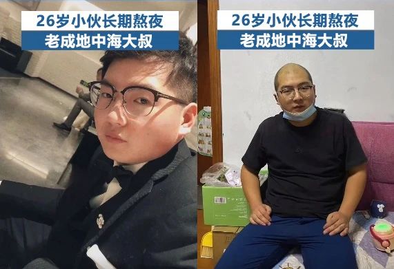 26岁男生“断崖式衰老”变大叔！加速衰老的6个生活习惯，一定要改！987 / 作者:健康小天使 / 帖子ID:314069
