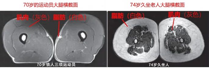 坚持锻炼相当于一年多赚17万元？坚持运动和从不运动的人，差别有多大？99 / 作者:健康小天使 / 帖子ID:314144