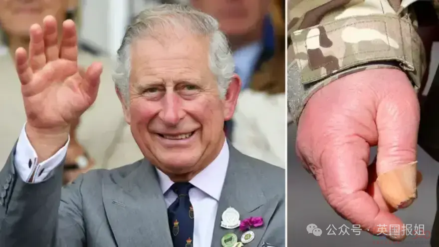 查尔斯被传驾崩，凯特王妃“复活”？民众目睹她活蹦乱跳上街买菜，网友：太瘦一定是替身！727 / 作者:放眼看世界 / 帖子ID:314258