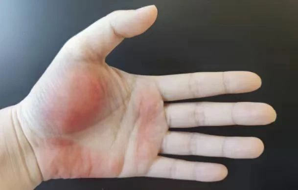 肝不好的人留意“一黄二红三黑”，伤肝的10个习惯要改改了！839 / 作者:健康小天使 / 帖子ID:314825