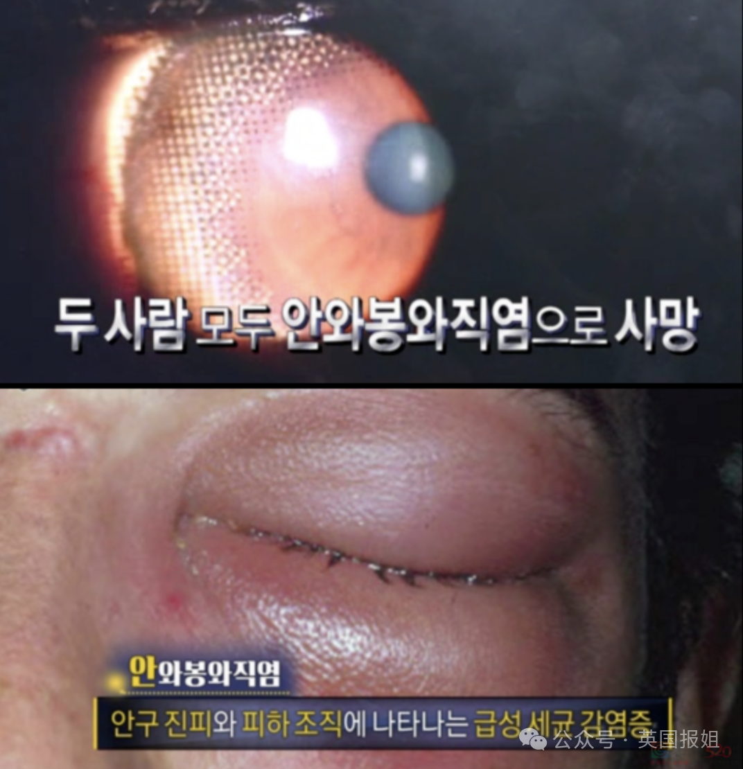 韩最毒美女连环杀人犯真容曝光像李英爱？反社会人格测试拿最变态满分，连弑两夫直接刺瞎双眼！787 / 作者:放眼看世界 / 帖子ID:314996