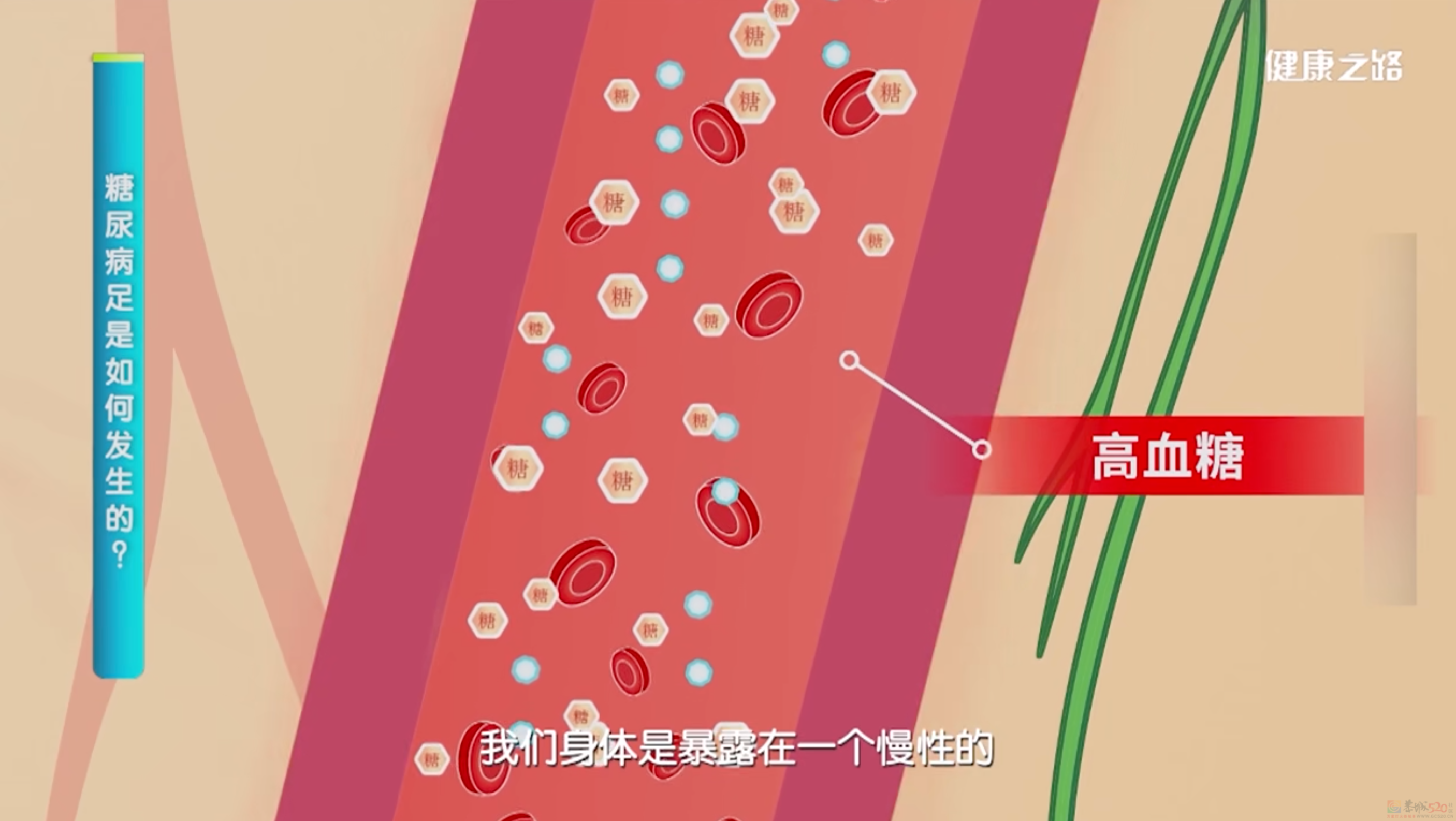留意！双脚出现5个表现，多半是血糖超标了！730 / 作者:健康小天使 / 帖子ID:315038