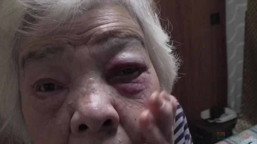 她拍下母亲变痴呆全过程，惹哭几十万网友，观众说：感谢你拍了这个故事！532 / 作者:放眼看世界 / 帖子ID:315147