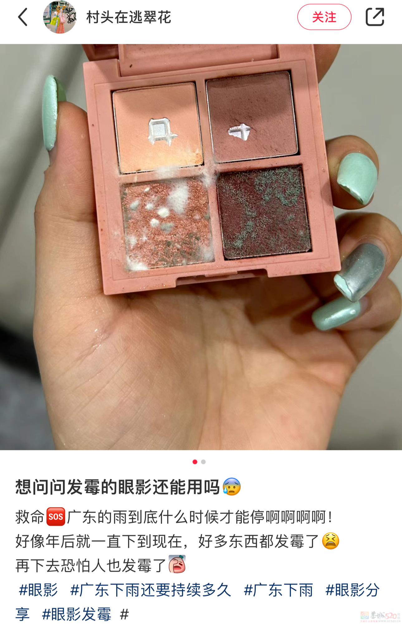 南方人最近从头到脚发霉，“总算明白发配岭南有多可怕了”887 / 作者:儿时的回忆 / 帖子ID:315784