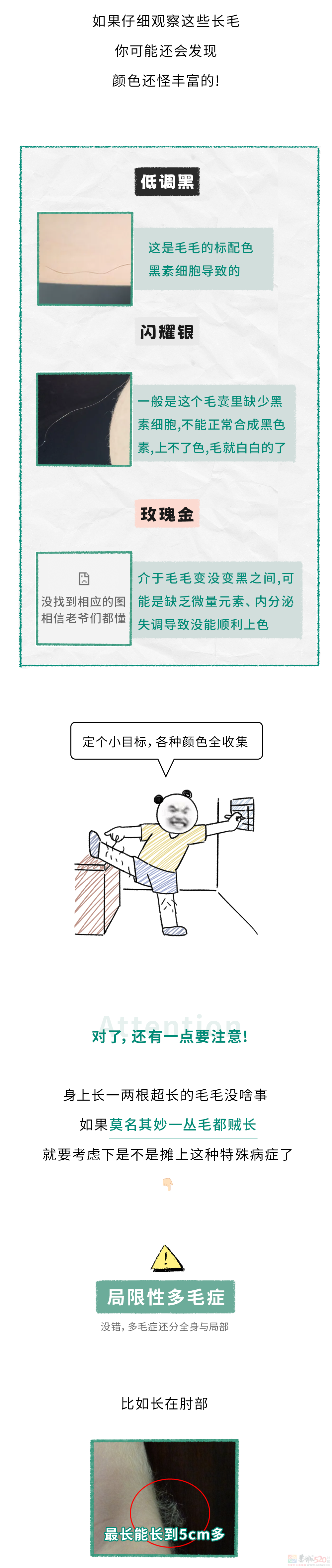 为啥身上会长出一两根特别长的毛毛？？？357 / 作者:儿时的回忆 / 帖子ID:316916