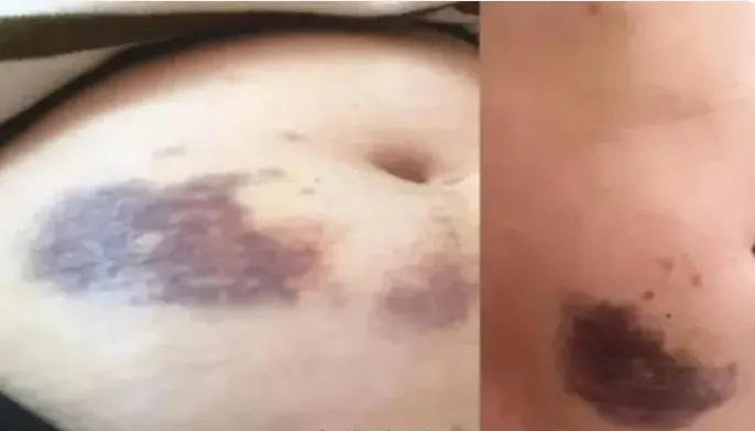 穿过200次婚纱的陈乔恩，还是嫁给了人人喊打的“渣男”……308 / 作者:儿时的回忆 / 帖子ID:317127